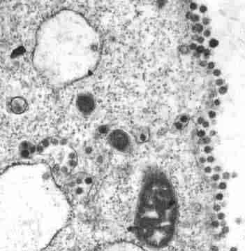 new images released prickly shape like a crown coronavirus under the microscope 